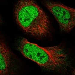 FAM59A Antibody, Novus Biologicals 25 &mu;L; Unlabeled:Antibodies, Polyclonal